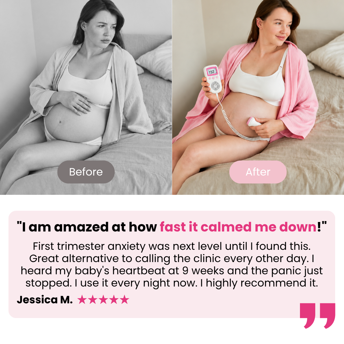 TinyPulse™ — Home Heartbeat Monitor for Pregnancy Peace of Mind
